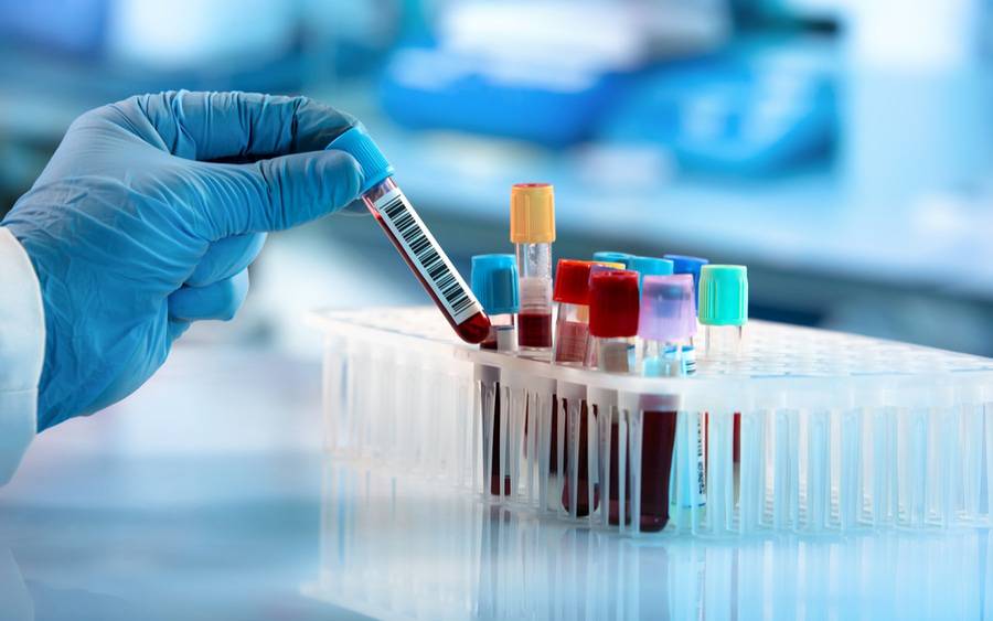 blood_test_samples